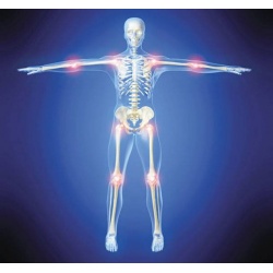 Οστεοπόρωση