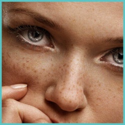 Θεραπεία Πανάδων, Λάμψη + Πρόληψη