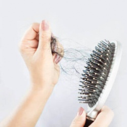 Τριχόπτωση