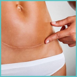 Για τις ουλές-Αναπλαστικές