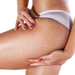 Πρόληψη Ραγάδων